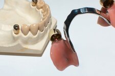 Bild 7 Dentallabor Kaarst in Kaarst