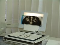 Bild 3 Schmitz in Wuppertal