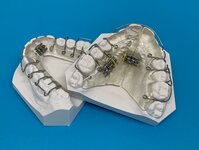 Bild 2 KFO - Team & Technik Kieferorthopädisches Fachlabor Christine Hohnecker in Ebrach