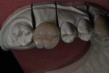 Bild 3 Dentaltechnik Köberlin GmbH in Pegnitz