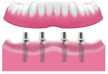 Bild 1 Maier in Schnaittenbach