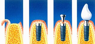 Bild 3 Poersch in Schönwald