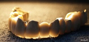 Bild 1 Mattonet in Fürth