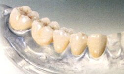 Bild 2 Poersch in Schönwald