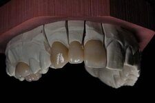 Bild 1 Dentaltechnik Köberlin GmbH in Pegnitz