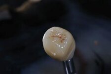 Bild 2 Dentaltechnik Köberlin GmbH in Pegnitz