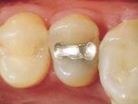 Bild 3 Nagengast in Bamberg