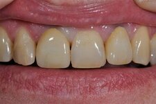 Bild 6 Dentaltechnik Köberlin GmbH in Pegnitz