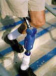 Bild 3 Völk Orthopädie- und Rehabilitationstechnik in Erlangen