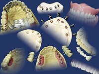 Bild 1 Schmelz + Vatter Zahntechnisches Labor GmbH in Nürnberg