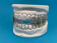 Bild 4 KFO - Team & Technik Kieferorthopädisches Fachlabor Christine Hohnecker in Ebrach