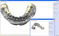 Bild 6 Dental Design Schneider Inh. Silvio Schneider in Waldenburg Sachs