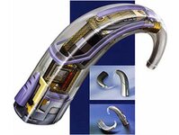 Bild 2 Hörgerätezentrum Fritsche GmbH Filiale Strehlen in Dresden