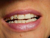 Bild 6 Zahnarztpraxis Beate Taubner in Zwickau