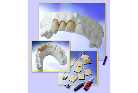 Bildergallerie Albert Rupprecht Dentallabor Mainleus