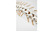 Kundenbild groß 10 Physiotherapie Markus Preiß Prophysio - Osteopathie - Training & Rehabilitation
