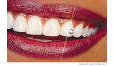 Kundenbild groß 4 Nagengast Zahnarztpraxis
