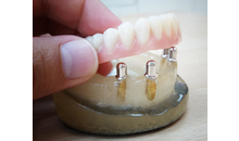 Kundenbild groß 2 Dental-Labor Handrich GmbH