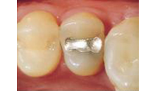Kundenbild groß 5 Nagengast Zahnarztpraxis
