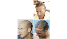 Kundenbild groß 1 GFH Gesellschaft für Haarästhetik mbH