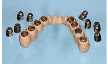 Kundenbild groß 4 M&M Dental-Labor OHG