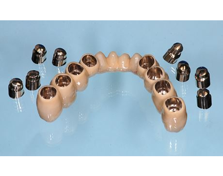 Kundenfoto 4 M&M Dental-Labor OHG