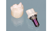 Kundenbild groß 10 M&M Dental-Labor OHG