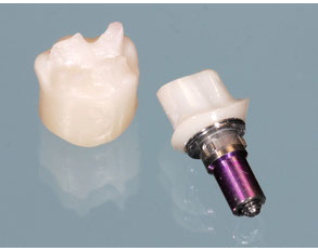 Kundenfoto 10 M&M Dental-Labor OHG