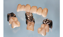 Kundenbild groß 9 M&M Dental-Labor OHG