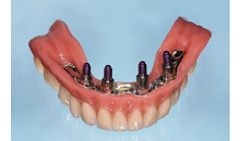 Kundenbild groß 3 M&M Dental-Labor OHG