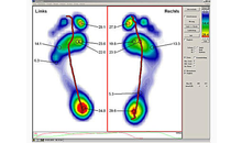 Kundenbild groß 4 Orthopädie-Schuhtechnik Güttler