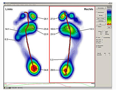 Kundenfoto 4 Orthopädie-Schuhtechnik Güttler