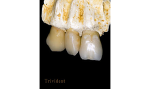 Kundenbild groß 4 Trivident Zahntechnik Aufderstroth GbR Thomas & Ines Aufderstroth