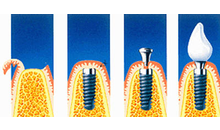 Kundenbild groß 3 Poersch Christian Dr.