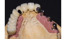 Kundenbild groß 5 Trivident Zahntechnik Aufderstroth GbR Thomas & Ines Aufderstroth