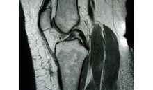 Kundenbild groß 5 Radiologie in Oberasbach Dres. Gentes & Kollegen