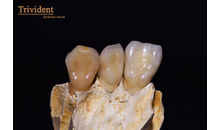 Kundenbild groß 1 Trivident Zahntechnik Aufderstroth GbR Thomas & Ines Aufderstroth