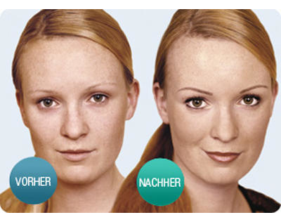 Kundenfoto 1 Kosmetik Schwamberger medical SPA - Permanent-Make-up