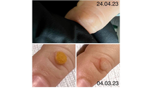 Kundenbild groß 9 Uzonova Olessya