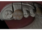 Bildergallerie Dentaltechnik Köberlin GmbH Pegnitz