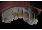 Bildergallerie Dentaltechnik Köberlin GmbH Pegnitz